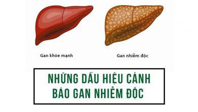 dau-hieu-canh-bao-gan-nhiem-doc