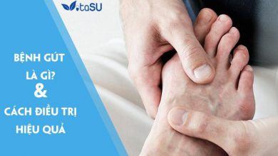 Tìm hiểu bệnh gút là gì và cách điều trị hiệu quả bạn nên biết