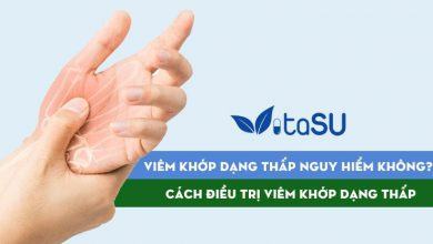 Bệnh viêm khớp dạng thấp nguy hiểm không? Cách điều trị ra sao?