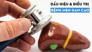 Tổng quan về bệnh men gan cao bạn cần biết để đảm bảo sức khỏe