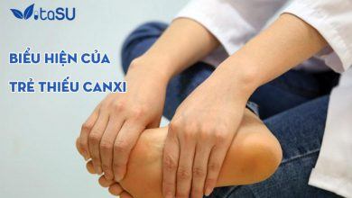 Tìm hiểu những biểu hiện của trẻ thiếu canxi mẹ cần biết